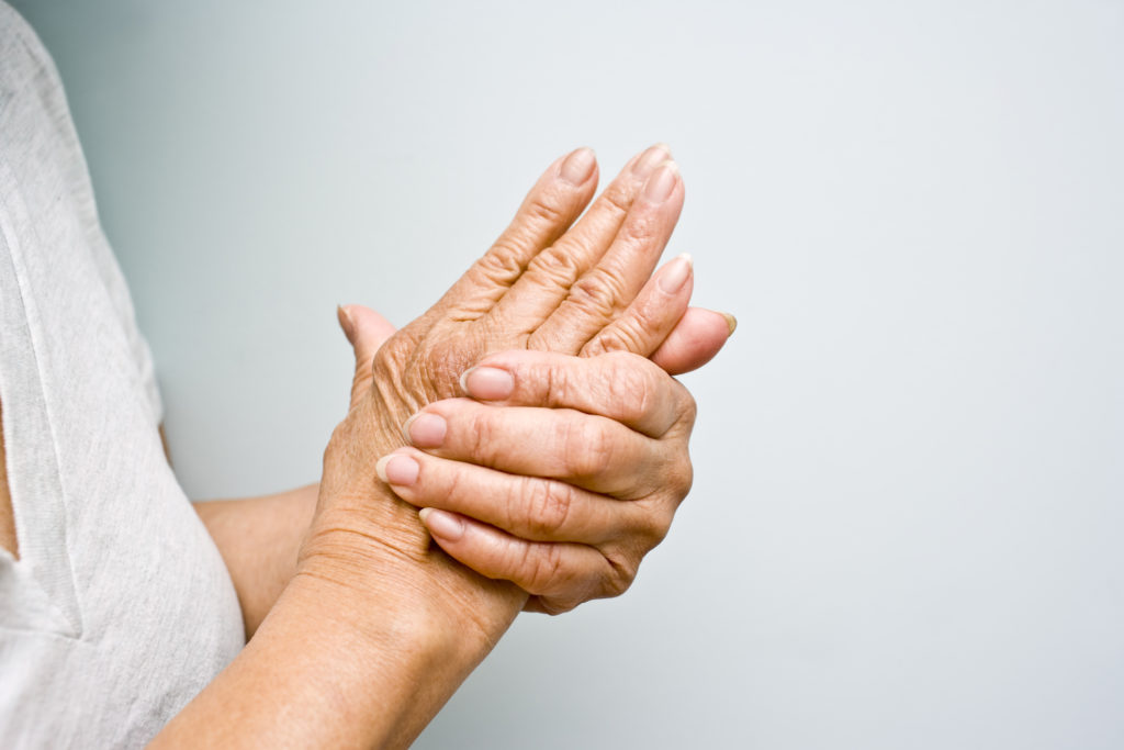 Can Physical Therapy Work for Arthritis Treatment?